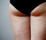 Effective exercises for cellulite at home